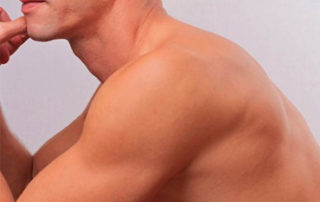 depilacion-laser-masculina-hombros-malaga