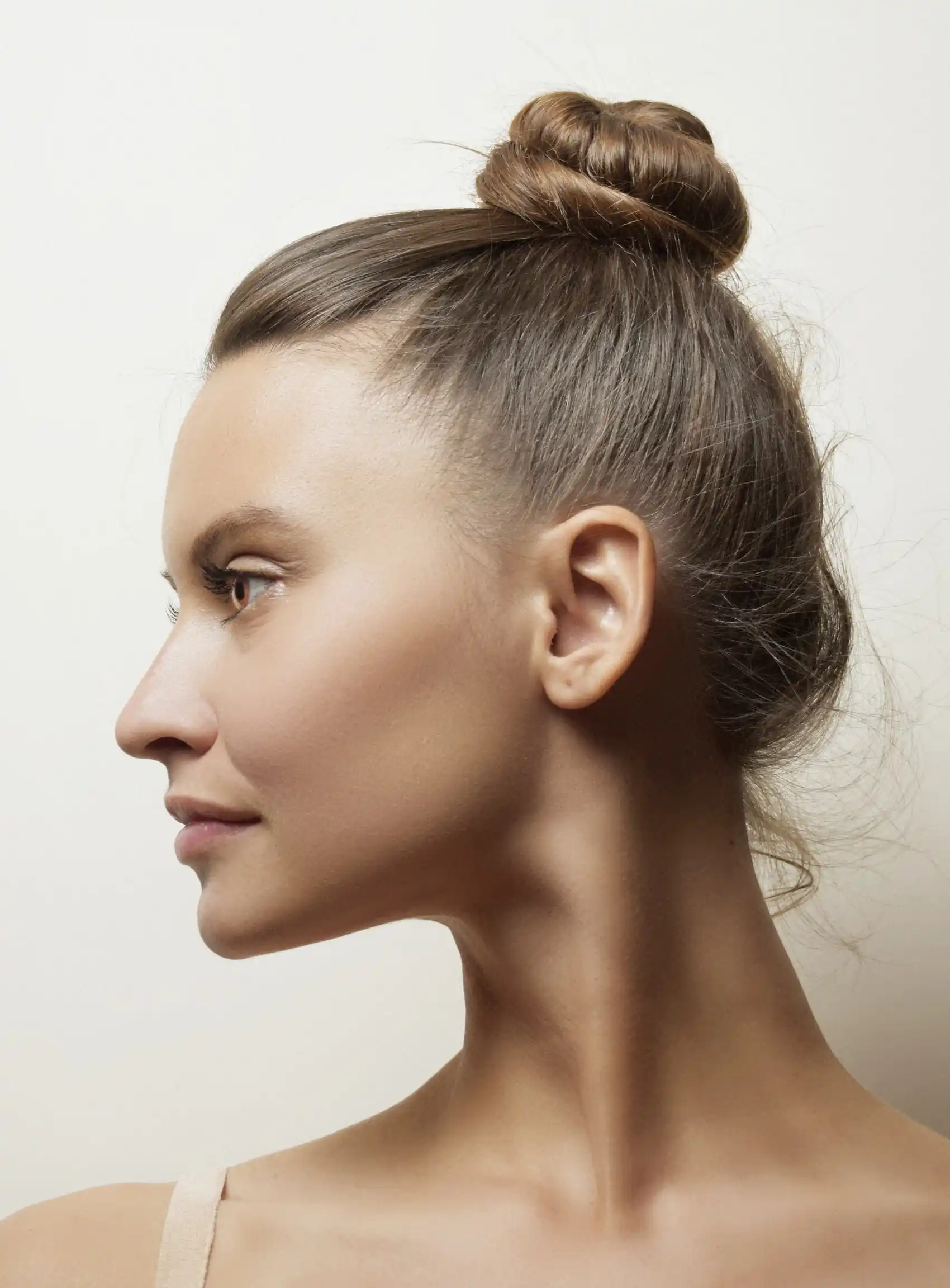 técnica FUE adecuada para tratar la alopecia en mujeres clínica Aesophy